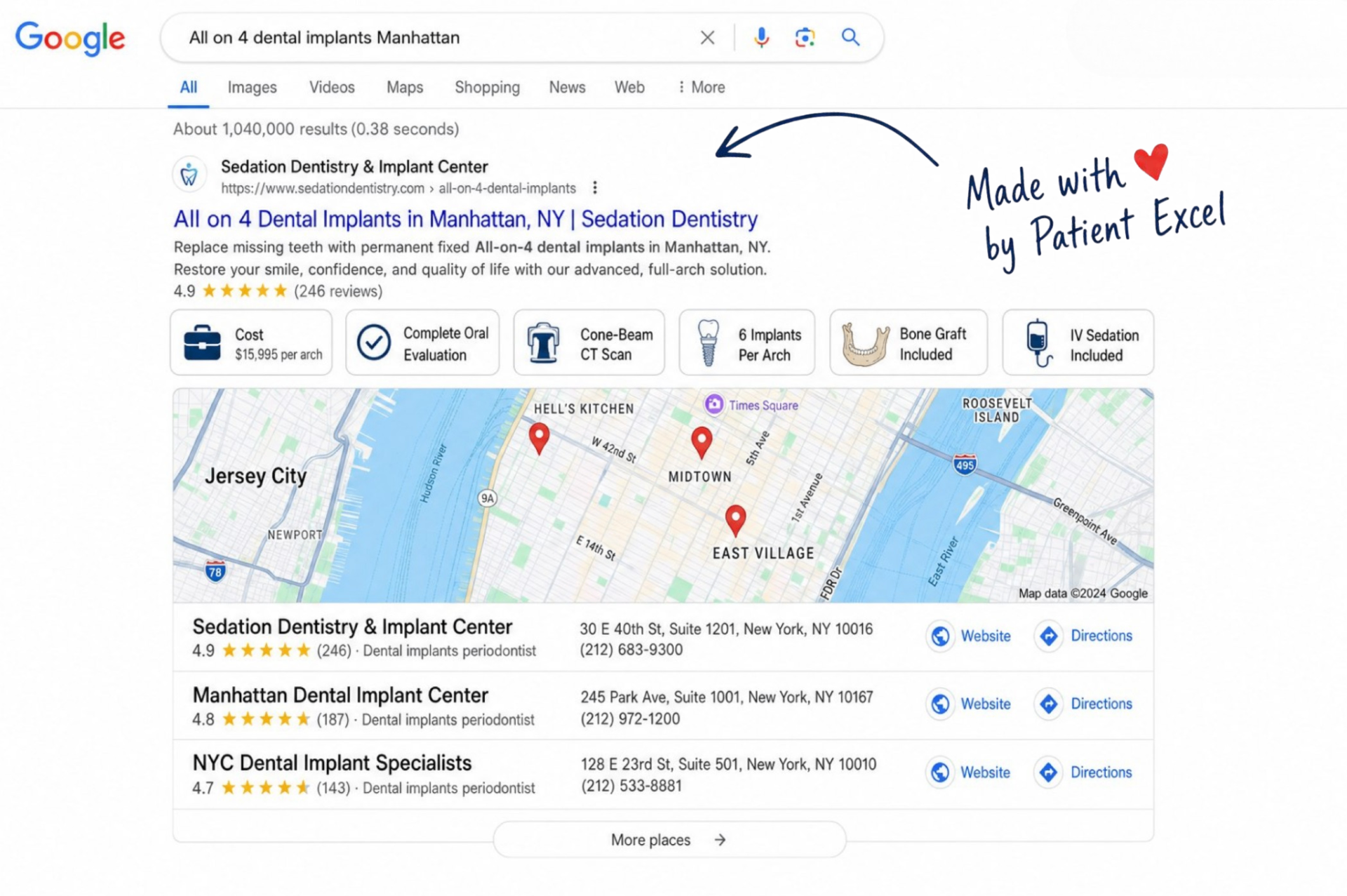 Client ranking #1 on Google for All on 4 dental implants